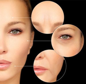 Botox